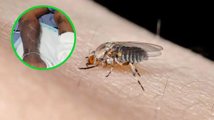 ตัวคุ่นกัดทำไมถึงตาย สสอ. เตือน ถูกกัดแล้วห้ามเกา หลัง ลุงวัย 69 ปี ถูกรุมกัดมีอาการแพ้ก่อนเสียชีวิต